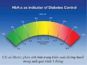 điều trị bệnh tiểu đường